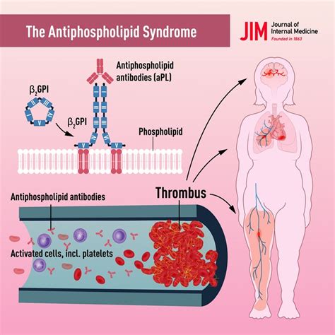 Antiphospho… 