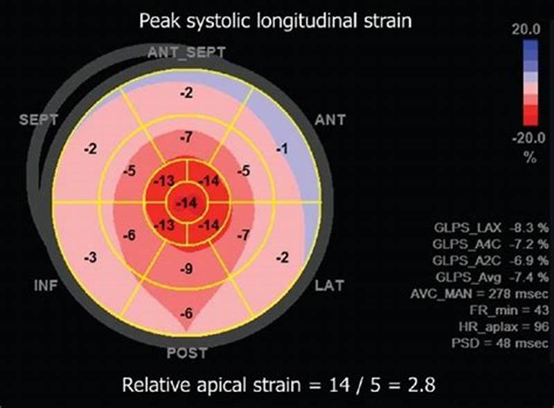 Apical Sparing Pattern