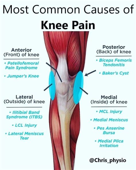 Medial Knee Pain