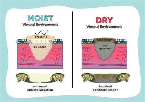 Avoid Moist Environments