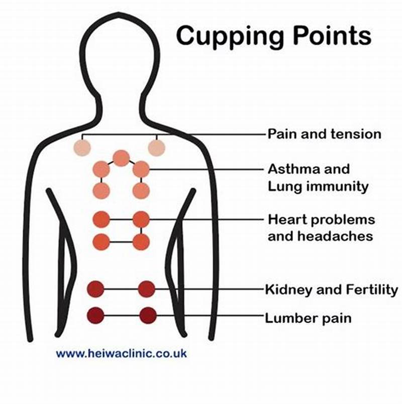 Back Cupping Pattern