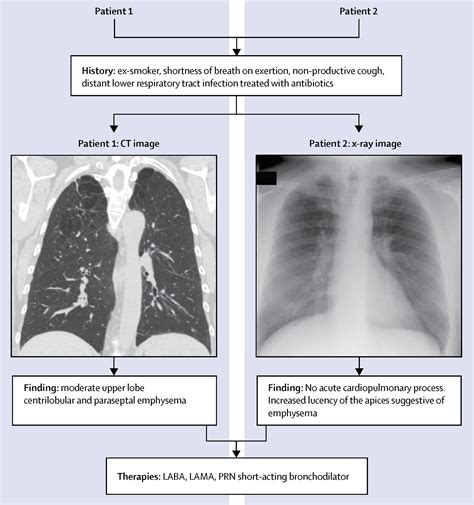 COPD vs