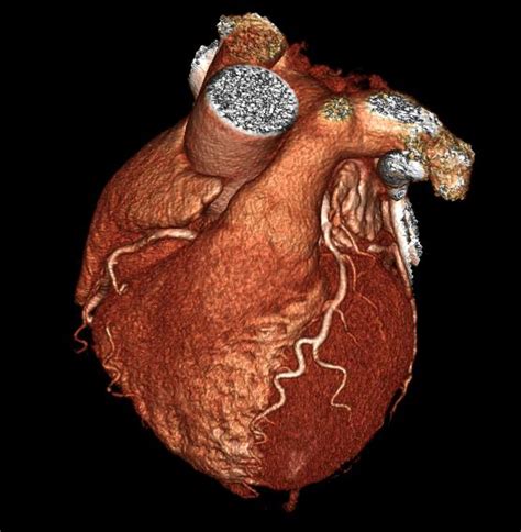 Heart 3D Imaging