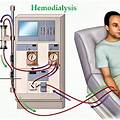 Conclusion in dialysis treatment