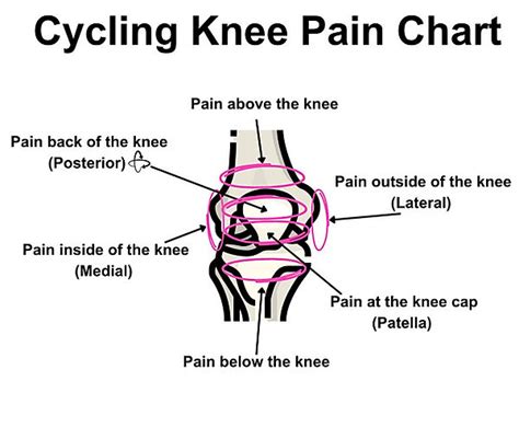 Cycling Knee Pain Chart