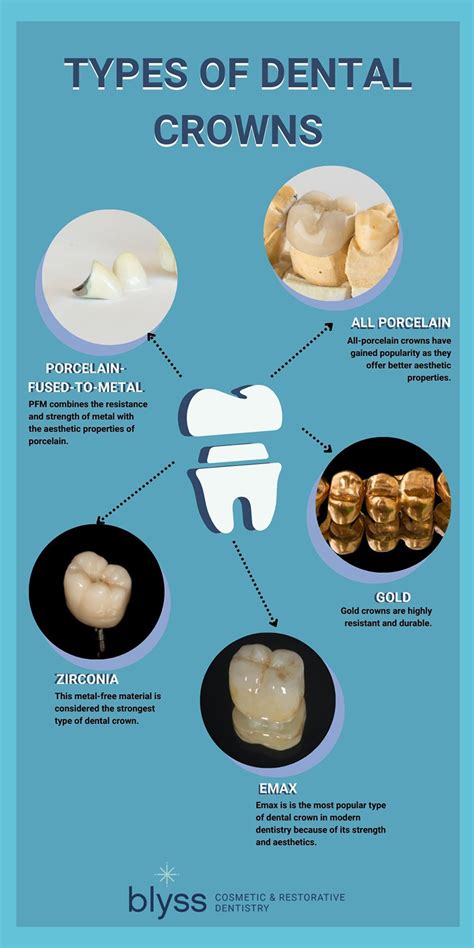 Dental Crown Types