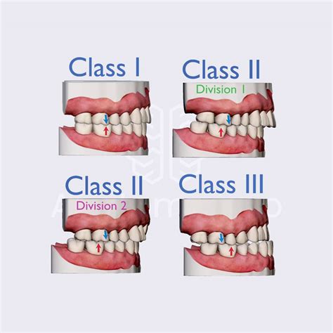 Dental Occlusion Chart