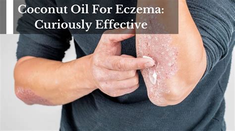 Eczema and Psoriasis Relief with Coconut Oil-Cannabis Mixture