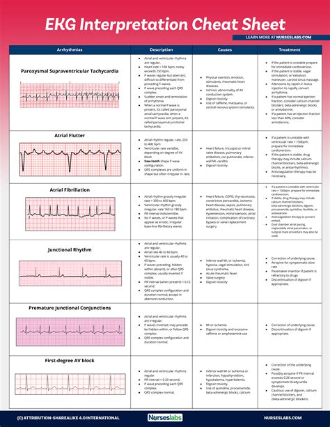 Ekg Practice Strips Printable