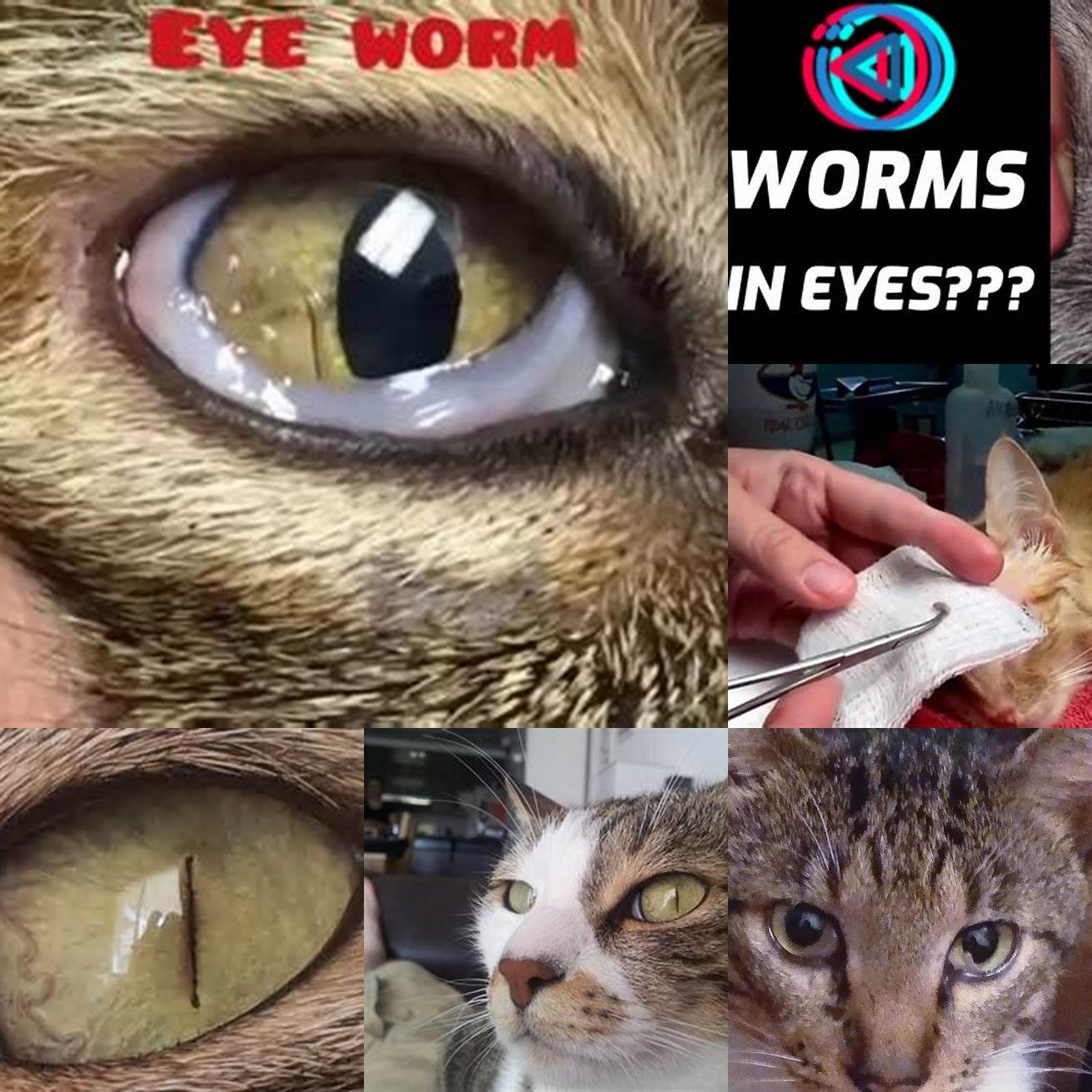 Eye Worms