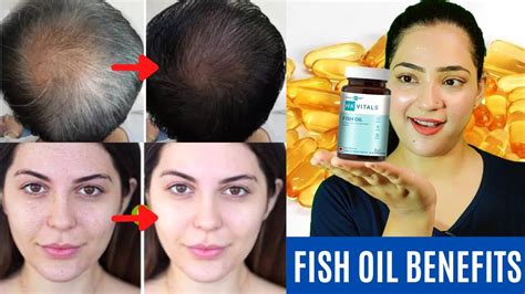 Fish oils improving hair thickness