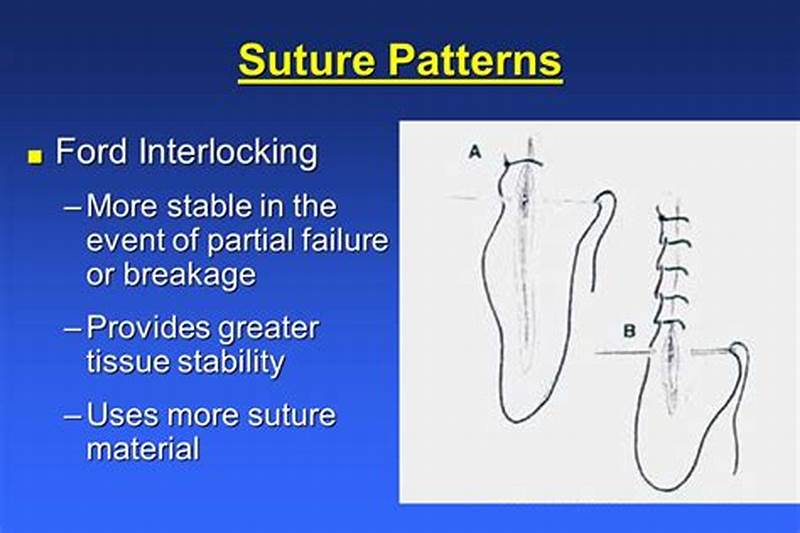 Ford Interlocking Suture Pattern