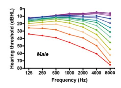 Frequency Hearing Age Chart