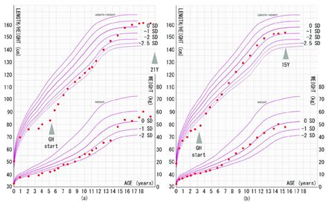 Growth Chart Growth Hormone Deficiency