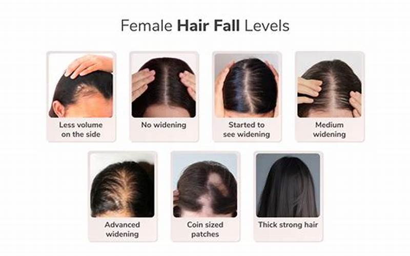 Hair Fall Pattern