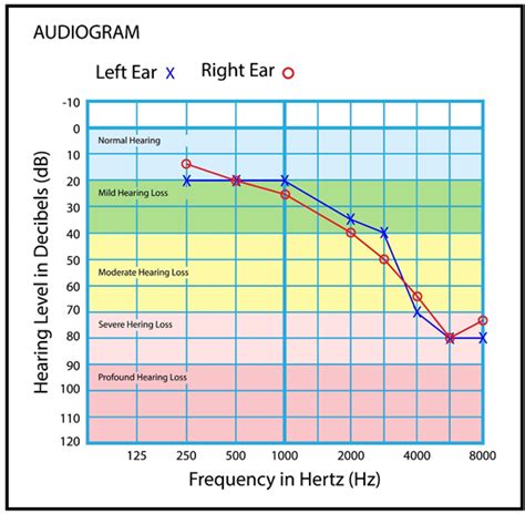 Hearing Range By Age Chart