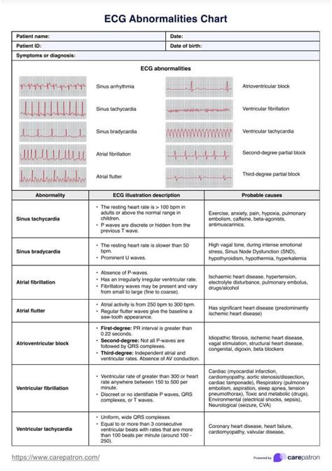 Heart Attack Ecg Abnormalities Chart