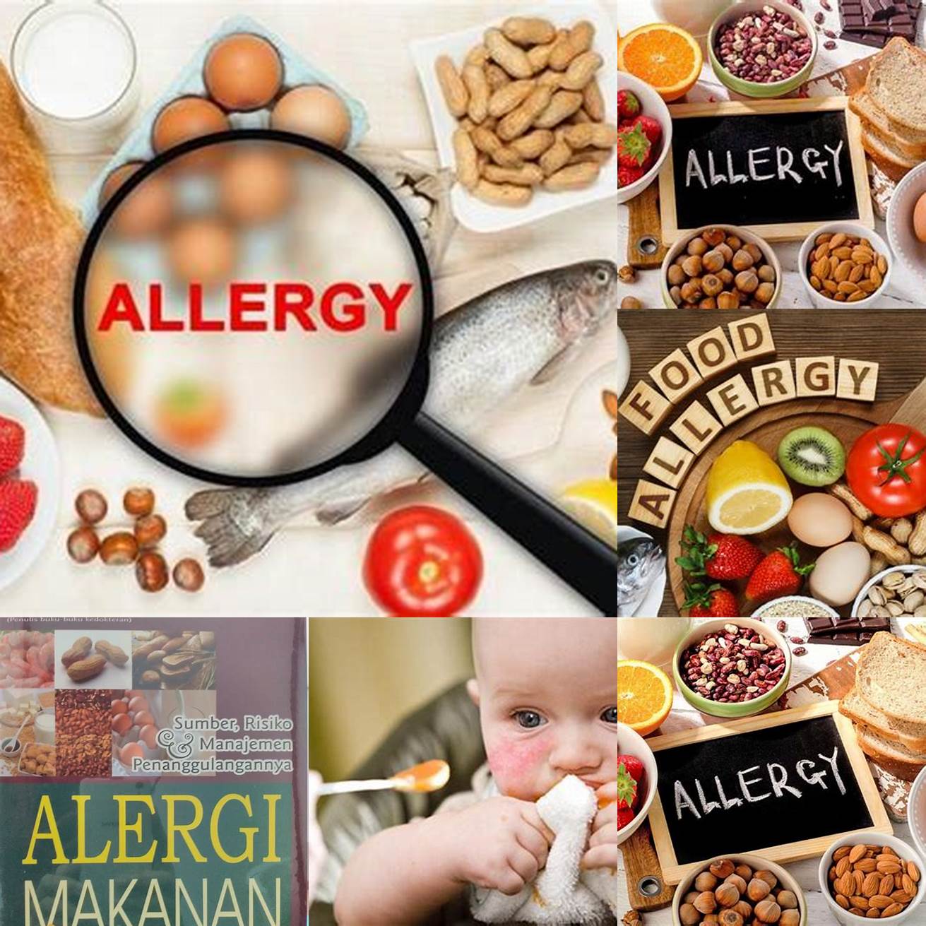 Hindari Konsumsi Makanan yang Menyebabkan Alergi