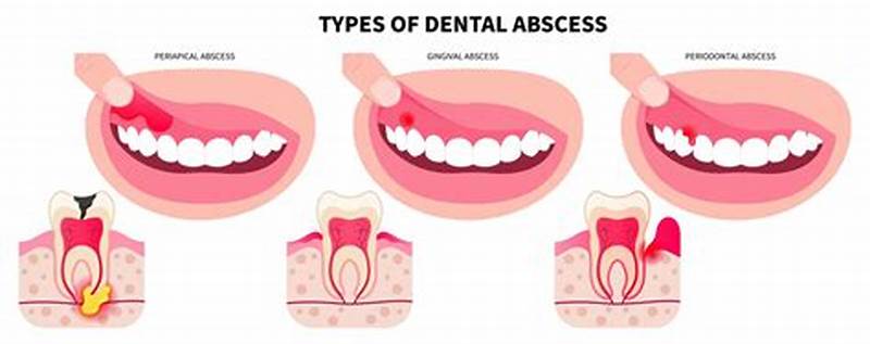 How Do Tooth Abscesses Form