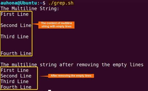 How do I fetch lines beforeafter the grep result in bash