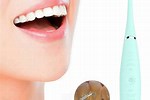 How to Use Dental Scaler at Home