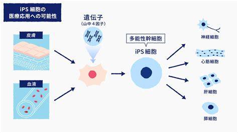 IPS