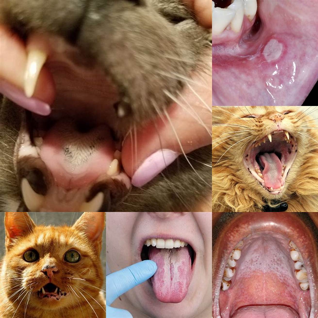 Injury Trauma to the tongue or mouth can also cause black spots to appear