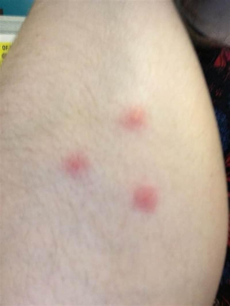 Insect Bites In Triangle Pattern