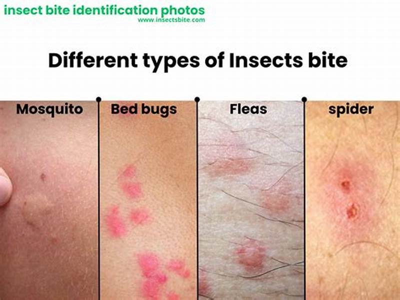 Insect Bites Three In A Row Pattern