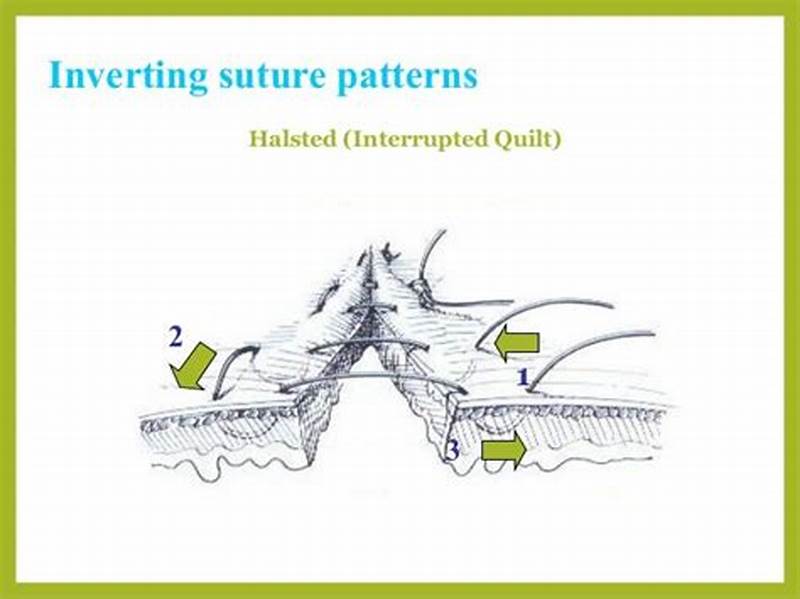 Inverting Suture Pattern