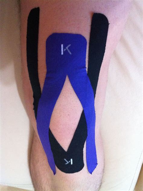 Tape Knee Pain