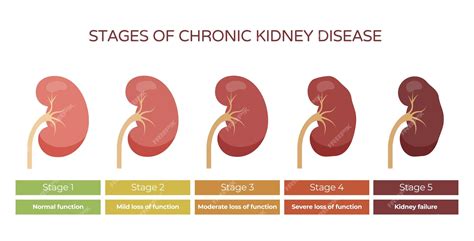 Kidney Stages Chart