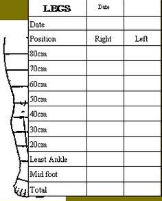 Lymphedema Measurement Chart