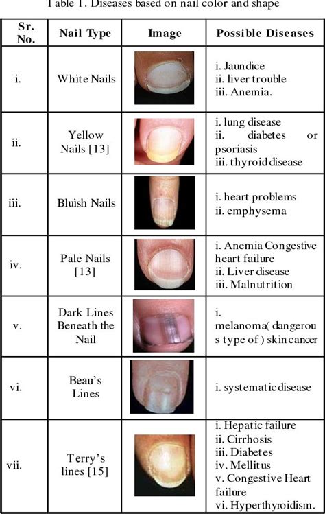 Nail Diseases Chart