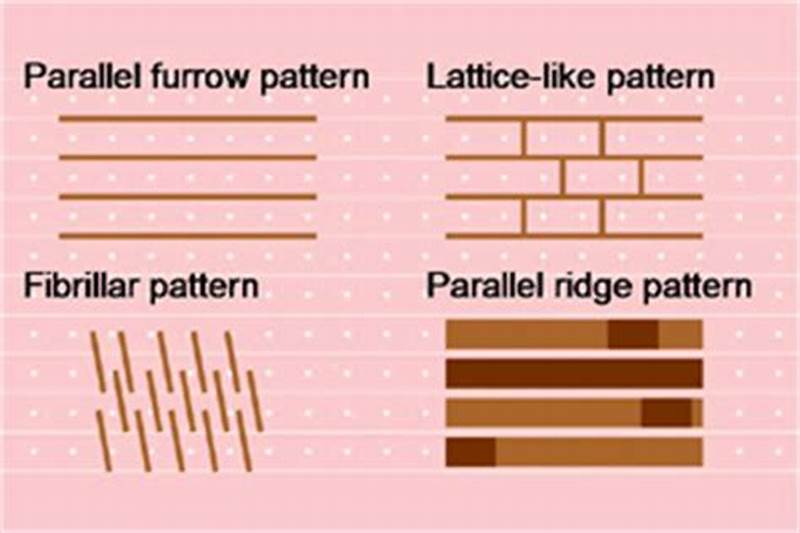 Parallel Ridge Pattern Vs Parallel Furrow