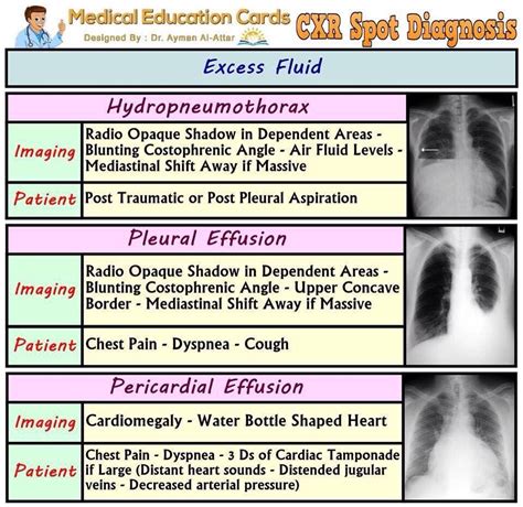 Pleural Fluid Color Chart