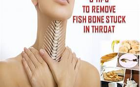 Prevent Fish Bone Stuck in Throat