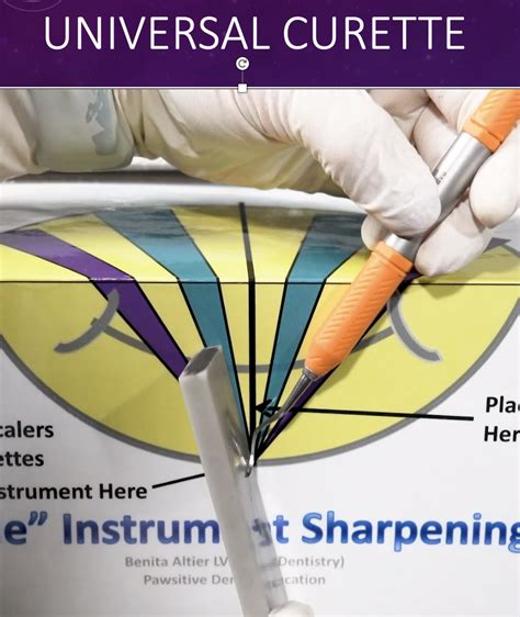 Printable Dental Instrument Sharpening Guide