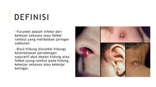 Rambut Hidung