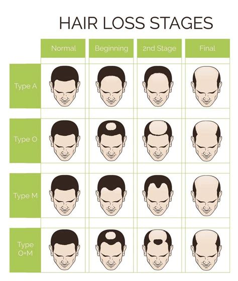 Hairline Types