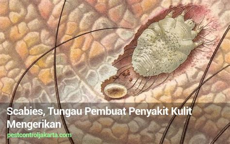 Scabies Tungau