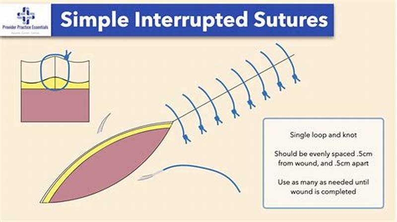 Simple Interrupted Suture Pattern