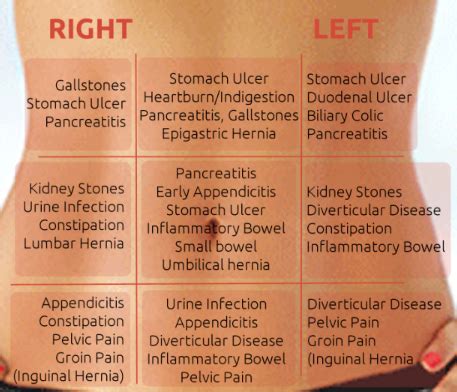 Stomach Pain Meaning Chart