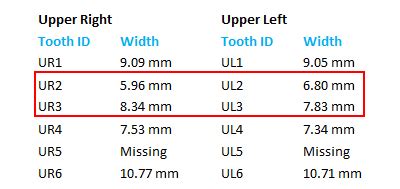 Teeth Size Chart