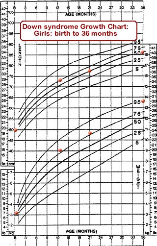 Trisomy 21 Growth Chart