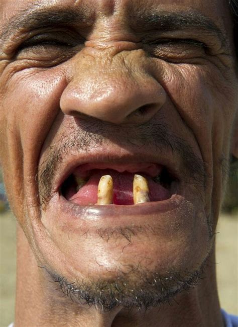Teeth. People