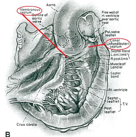 Septum Anatomy