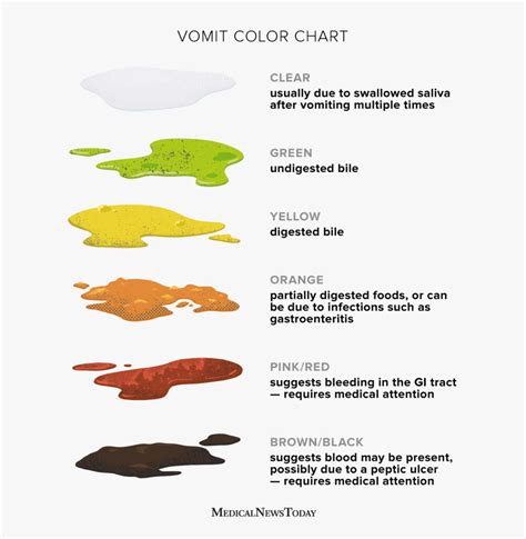 Vomiting Color Chart