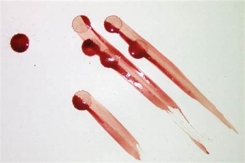 Wipe Pattern Definition Forensics