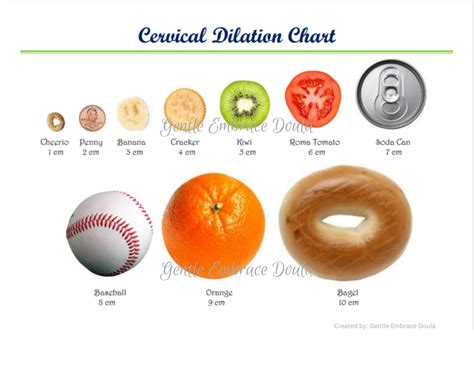 Womens Dilation Chart